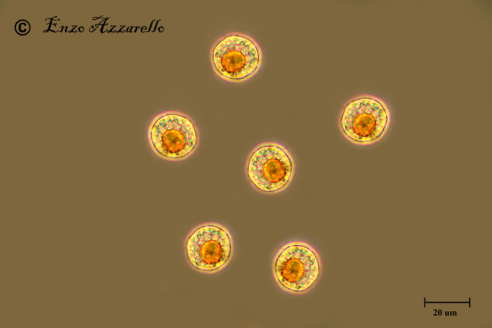 Haematococcus pluvialis stadio palmelloide o sbaglio?